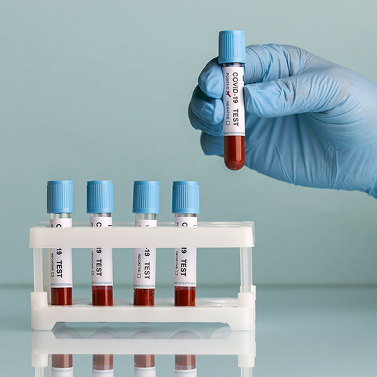 4. BMHP Laboratorium